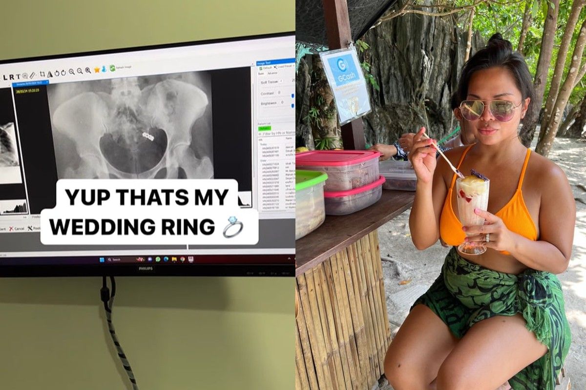 Жінка була дуже втомлена Жінка була дуже втомлена