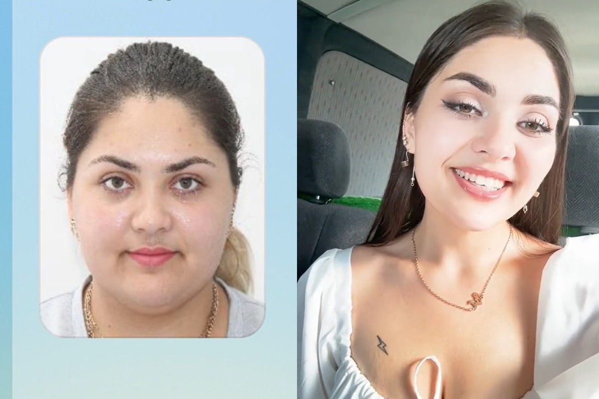 Дівчата показують, як змінились до невпізнання Дівчата показують, як змінились до невпізнання