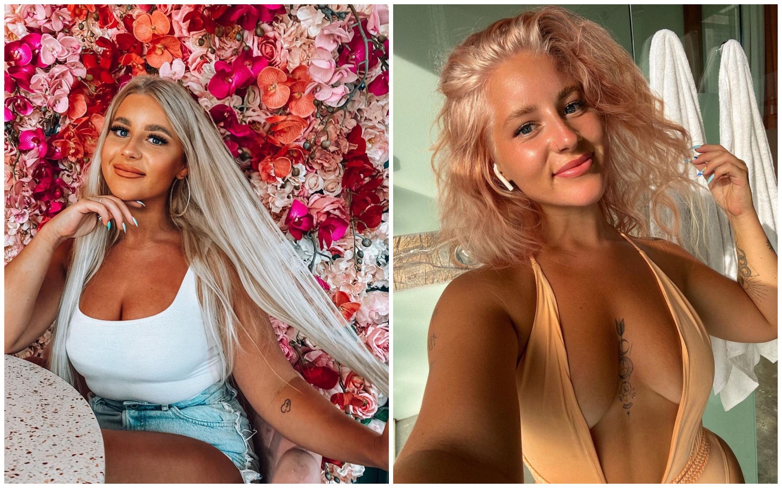 Девушка потеряла почти все волосы после отпуска на Бали Девушка потеряла почти все волосы после отпуска на Бали